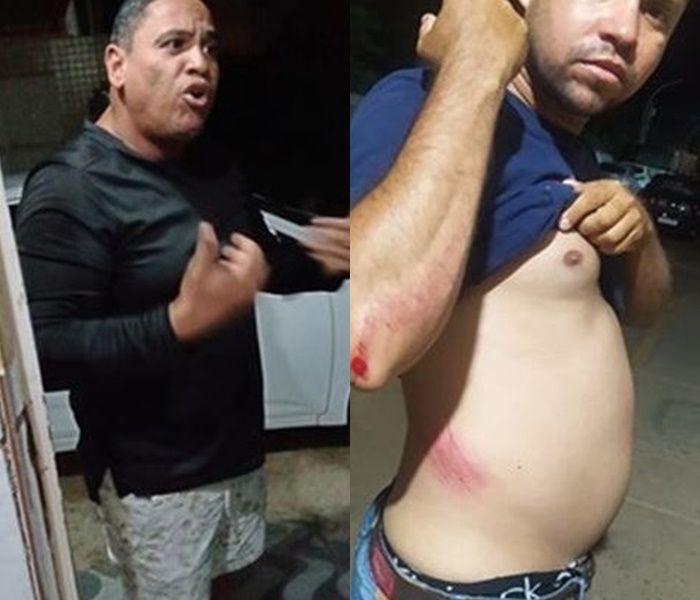 Vereador Aníbal Araújo vai às vias de fato com mototaxista Romário Pacheco. Ambos alegam agressão e realizam exame de corpo de delito
