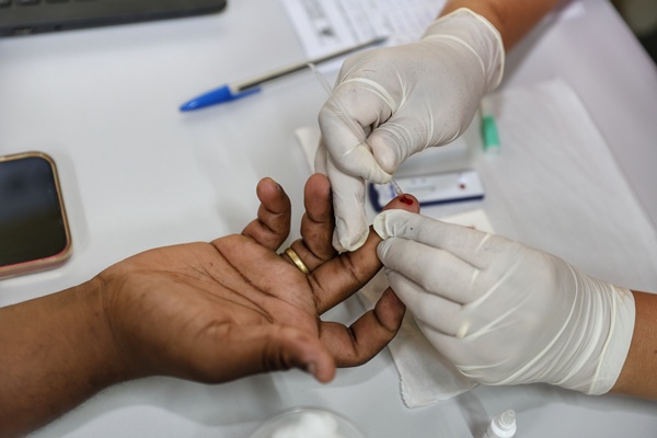  Preparação da Sesab garante atendimentos a vítimas de queimaduras