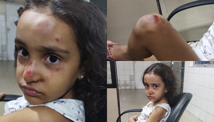 Criança de cinco anos sofre agressão em Juremal e mãe da criança pede internamento da doente mental